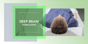 Deep Brain Stimulation