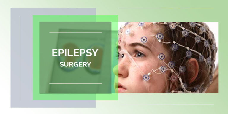 Epilepsy surgery