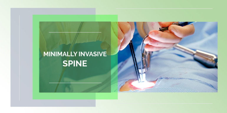 Minimally invasive spine surgery