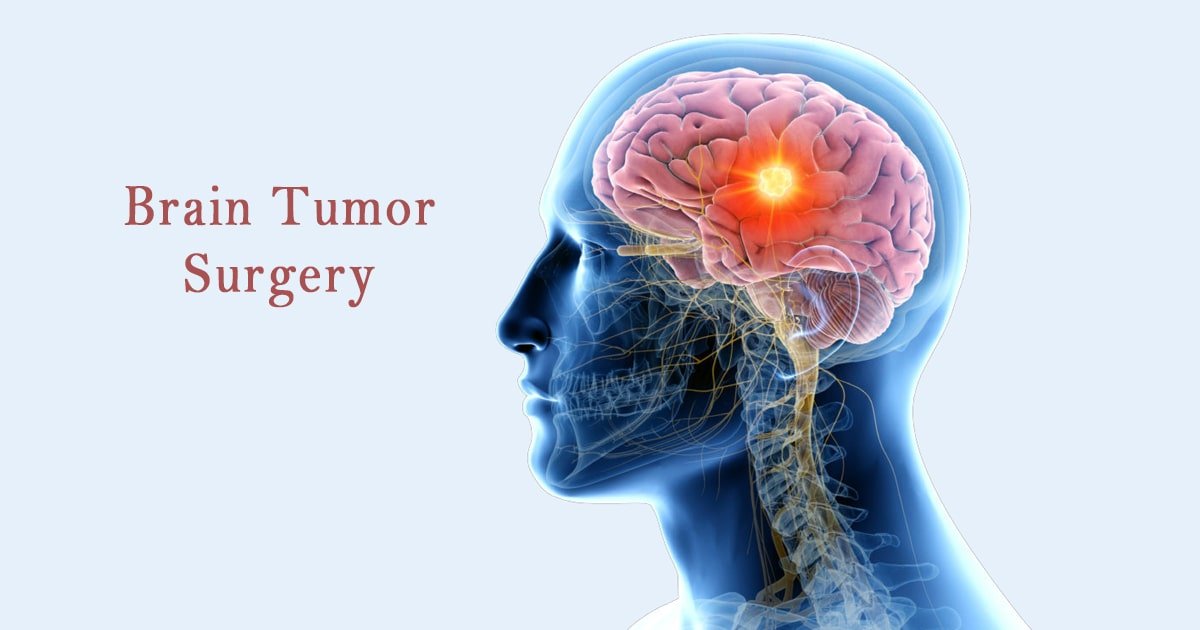 Brain Tumor