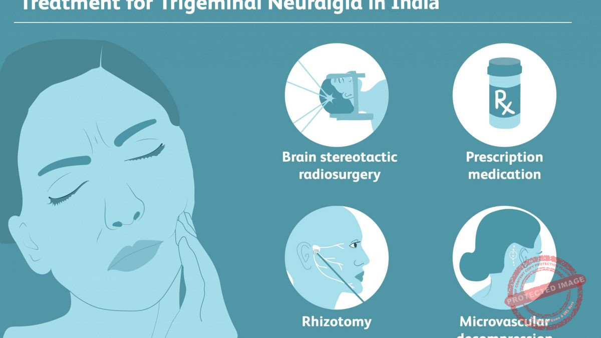 Trigeminal Neuralgia Treatment Guidelines